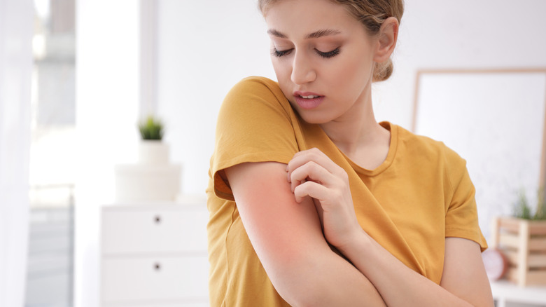 A woman scratching her arm