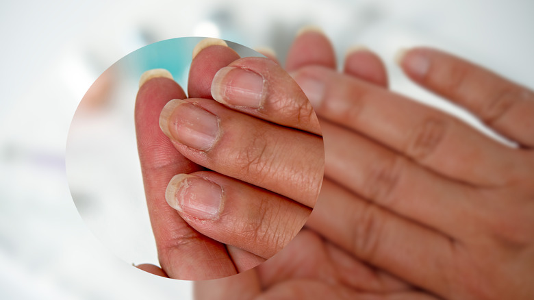 Does Water Weaken Your Nails?