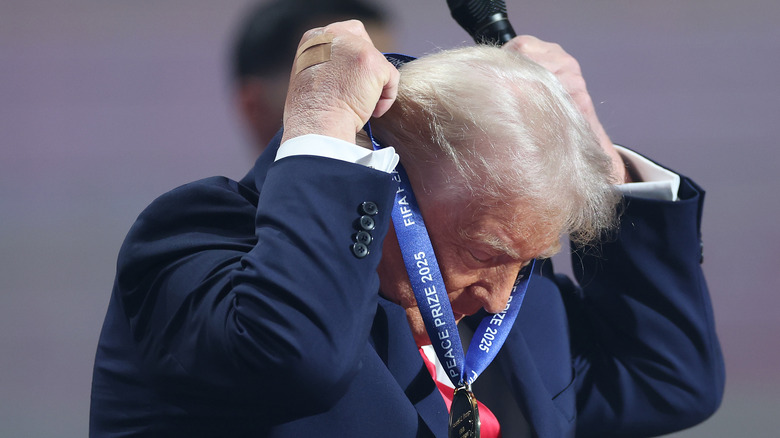 Donald Trump putting on FIFA medal bandaged hand