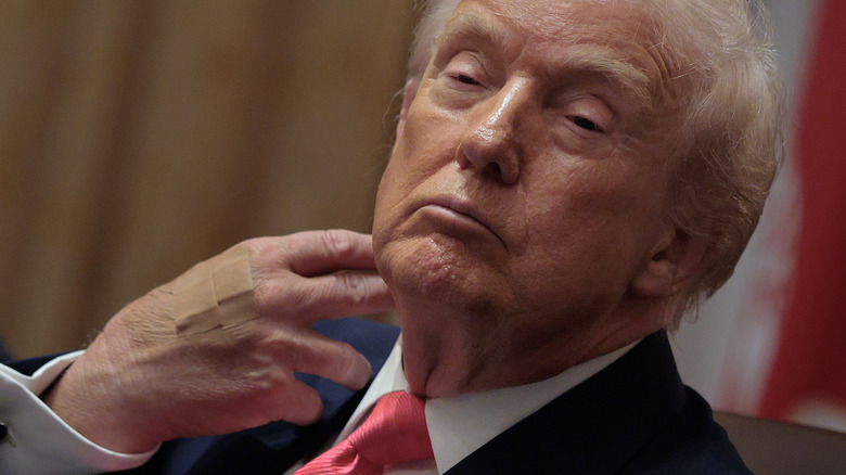 Donald Trump with a bandaged hand