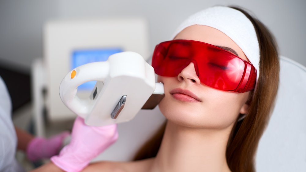 laser resurfacing