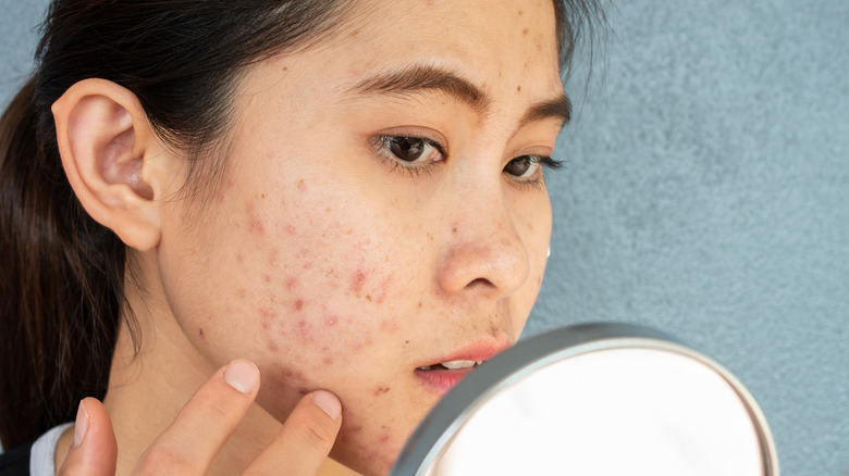 woman analyzing acne in mirror