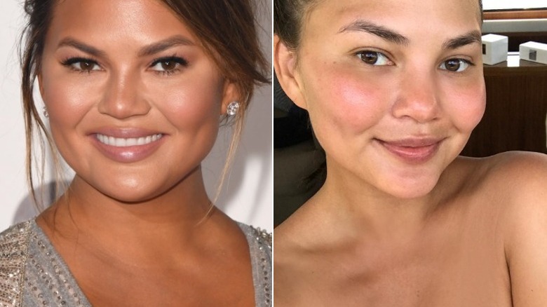 Chrissy Teigen