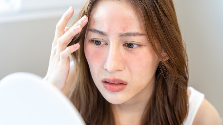 woman with facial redness