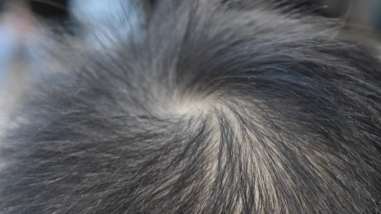 Closeup of cowlick in boy's hair