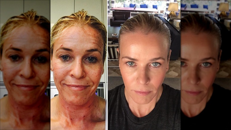 Chelsea Handler smirking in side-by-side pics.