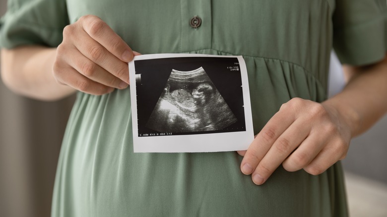 Pregnant woman holding ultrasound photo