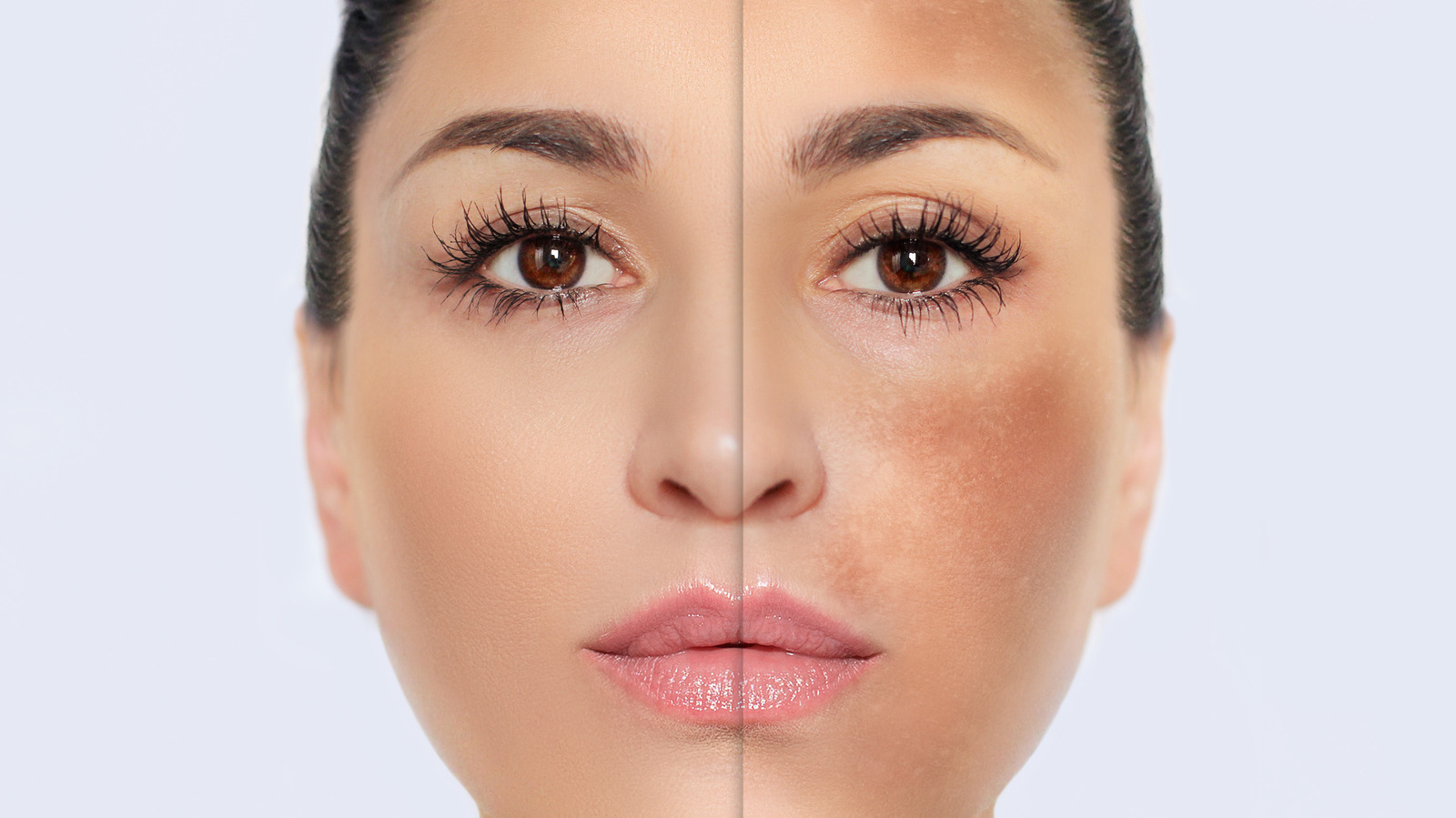 Here's What Really Causes Hyperpigmentation