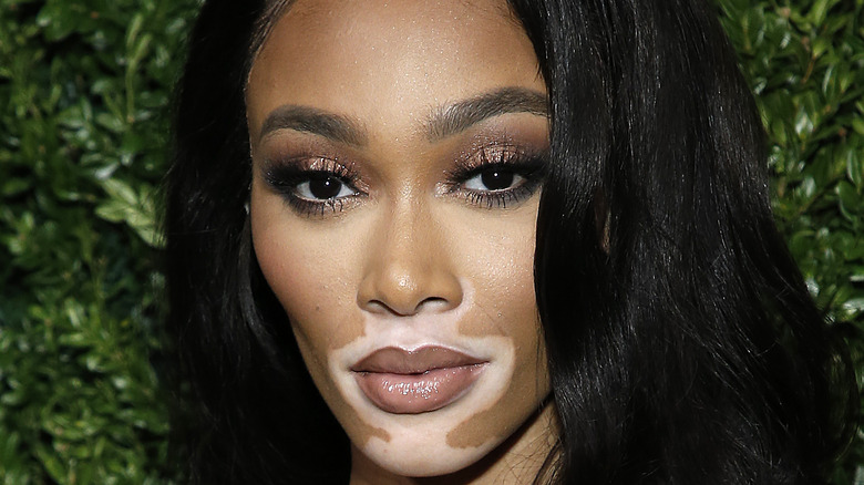 Winnie Harlow close-up