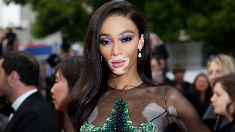 Winnie Harlow on a red carpet