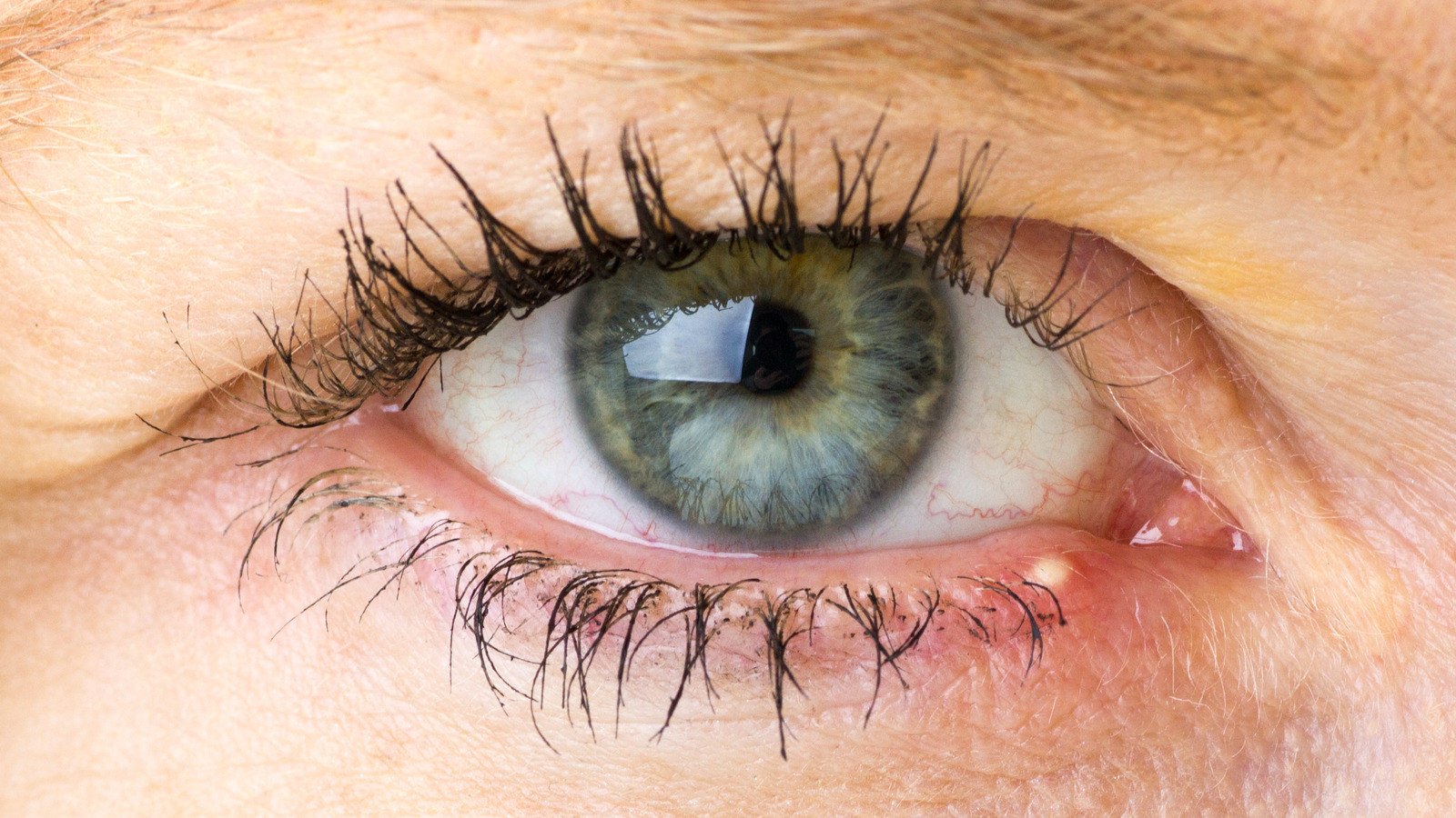 Here's What's Really Causing Your Stye - The List 