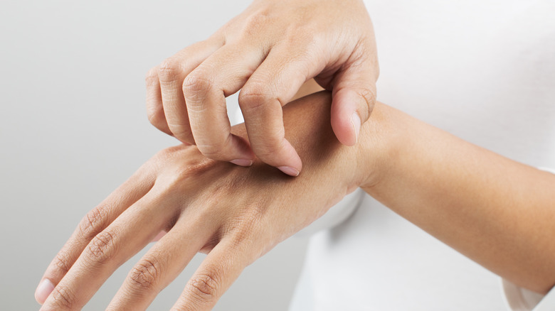 Woman scratches itchy hand