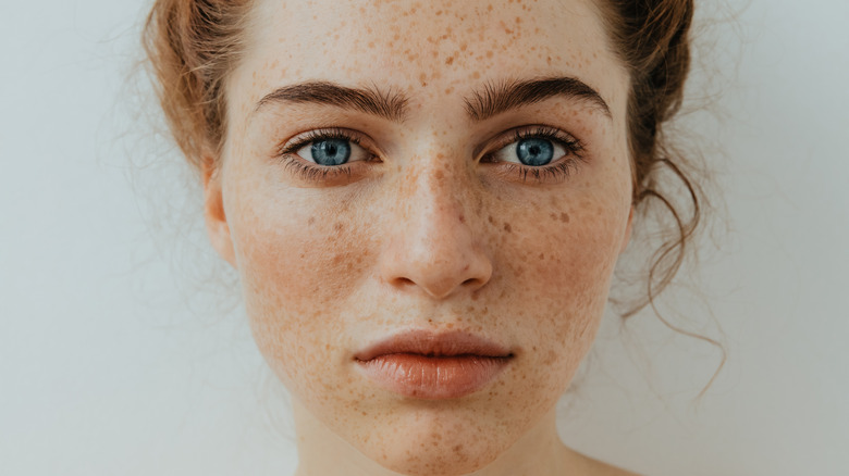 Woman with freckles