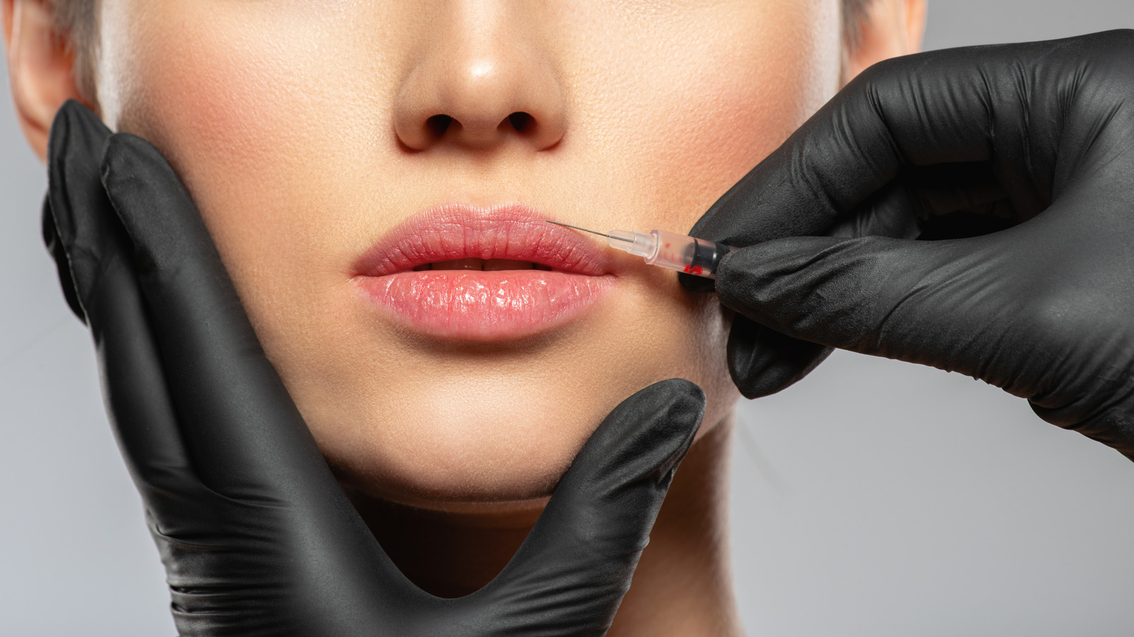 How Much Does A Lip Flip Procedure Cost?