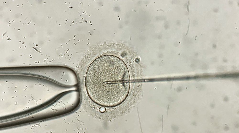 In vitro fertilization
