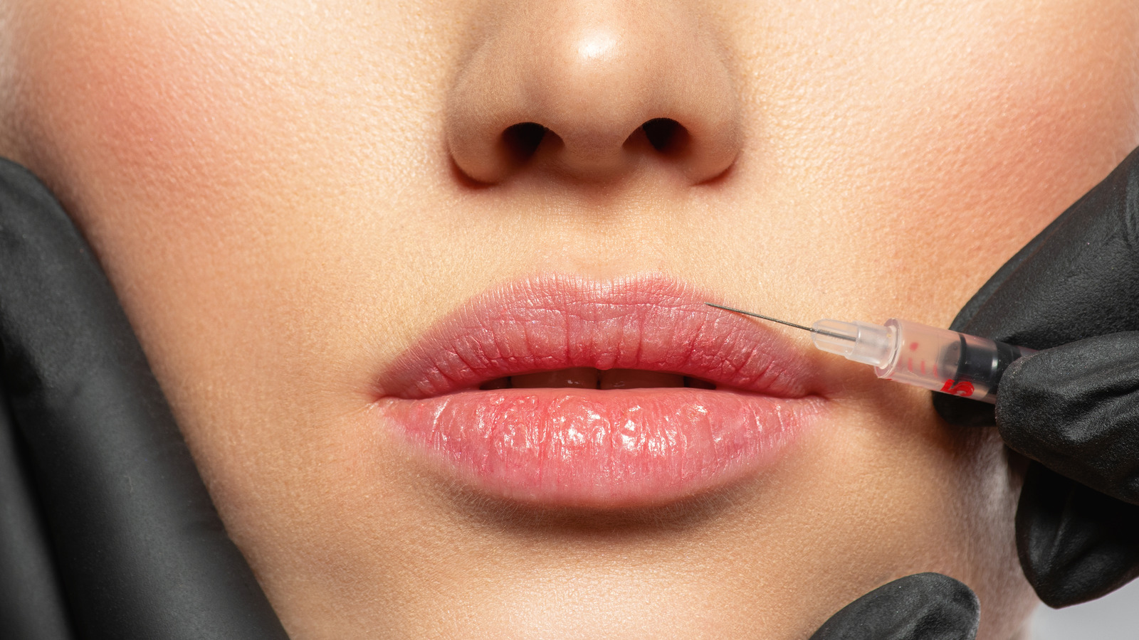 Getting My How Much Are Lip Injections In Houston 1efi49 To Work thumbnail