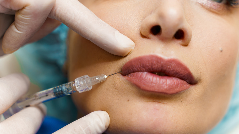 woman getting upper lip botox