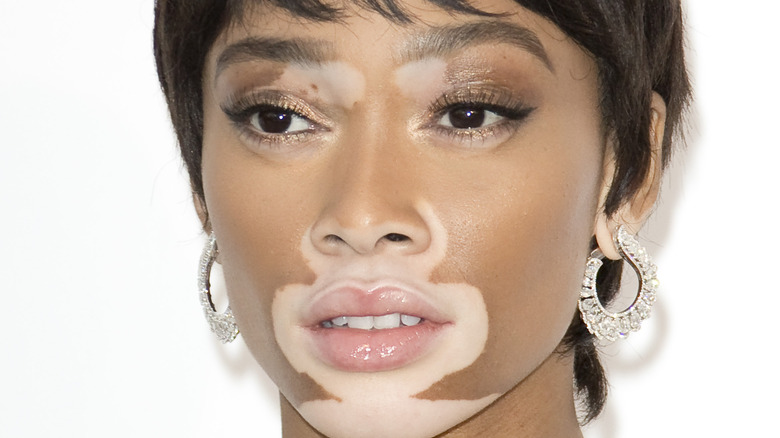 Winnie Harlow smiling