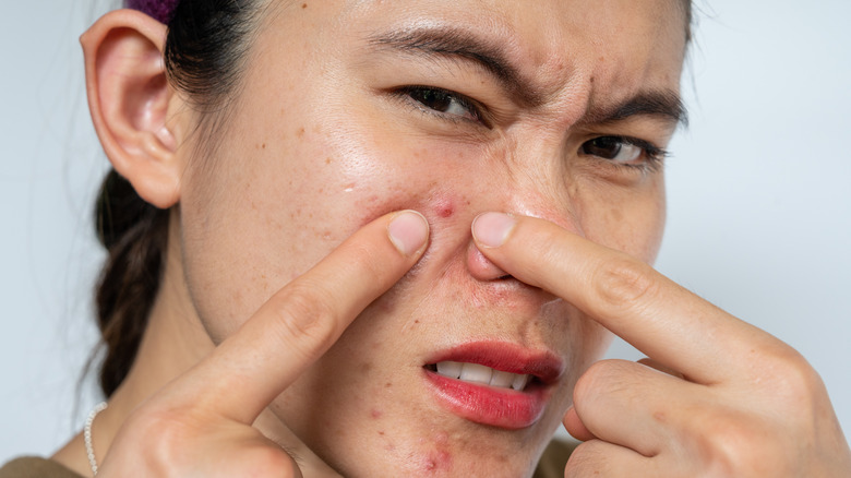 Woman popping pimple