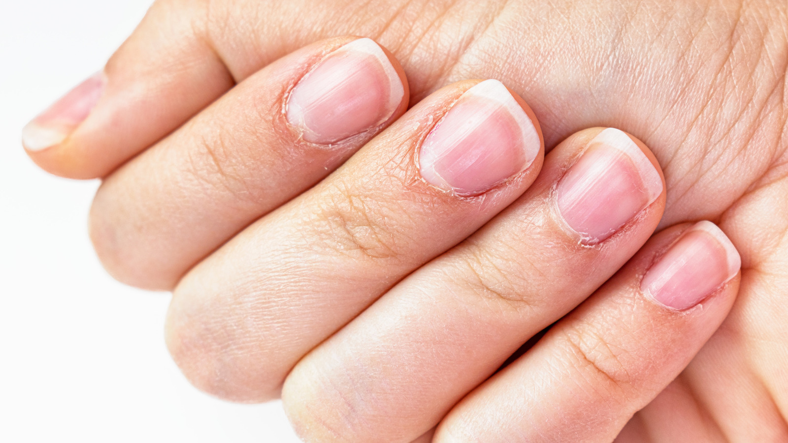 Why does a little flap of skin grow out right under some of my fingernails  and toenails? Is there any good way of (painlessly) removing them? - Quora
