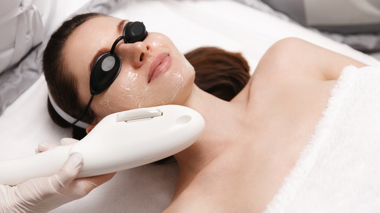 Woman receiving an IPL photofacial 