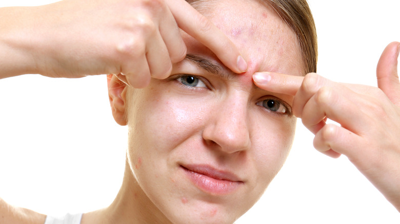 Is Popping Pimples Bad For You 