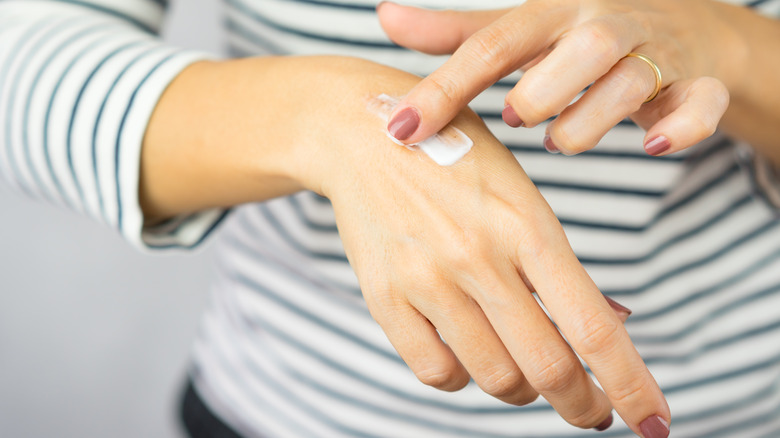 A woman applying scar removal cream on her hand