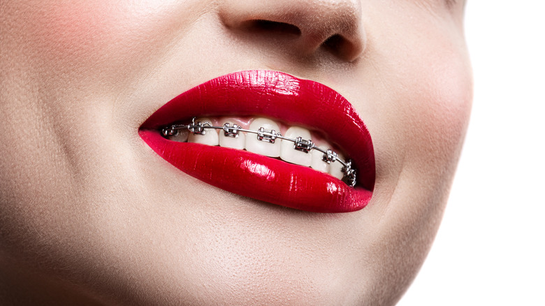 A woman wearing shiny metallic lipstick