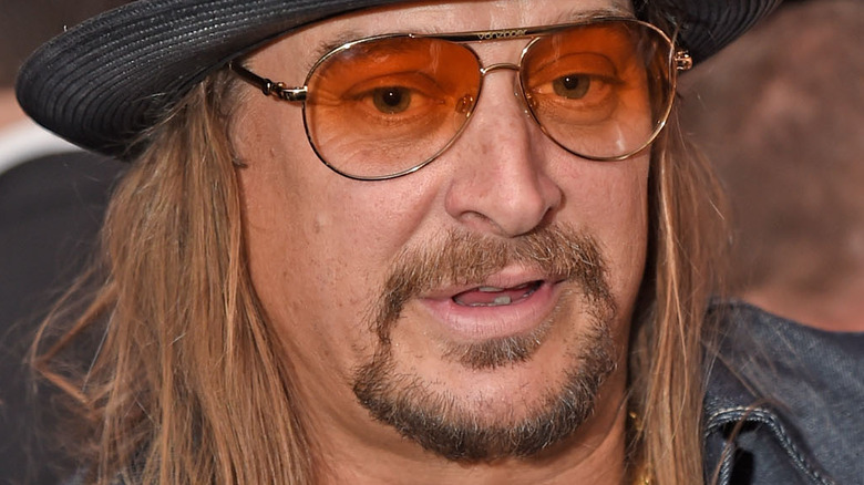 Kid Rock posing in sunglasses