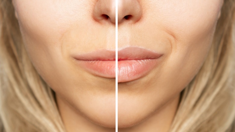 woman's lips split by fuller and thinner side