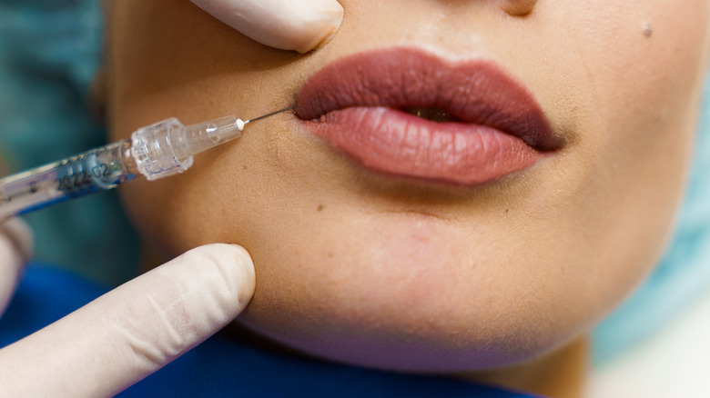 woman getting lip injection