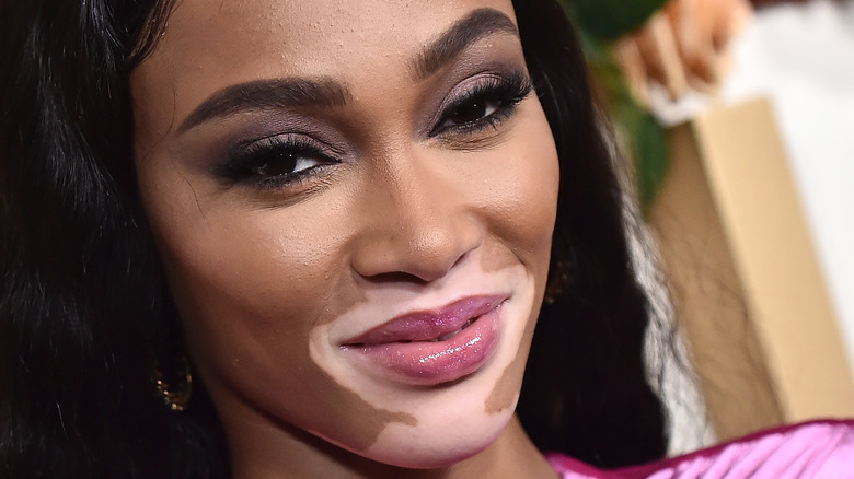 Winnie Harlow smiling 