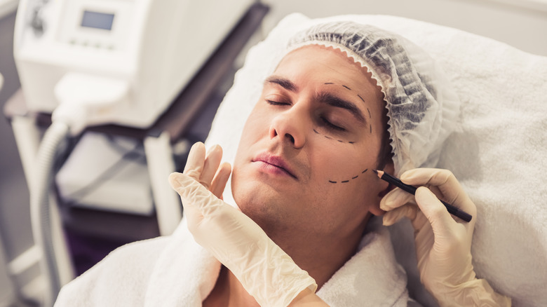 man with facial surgery lines drawn on face