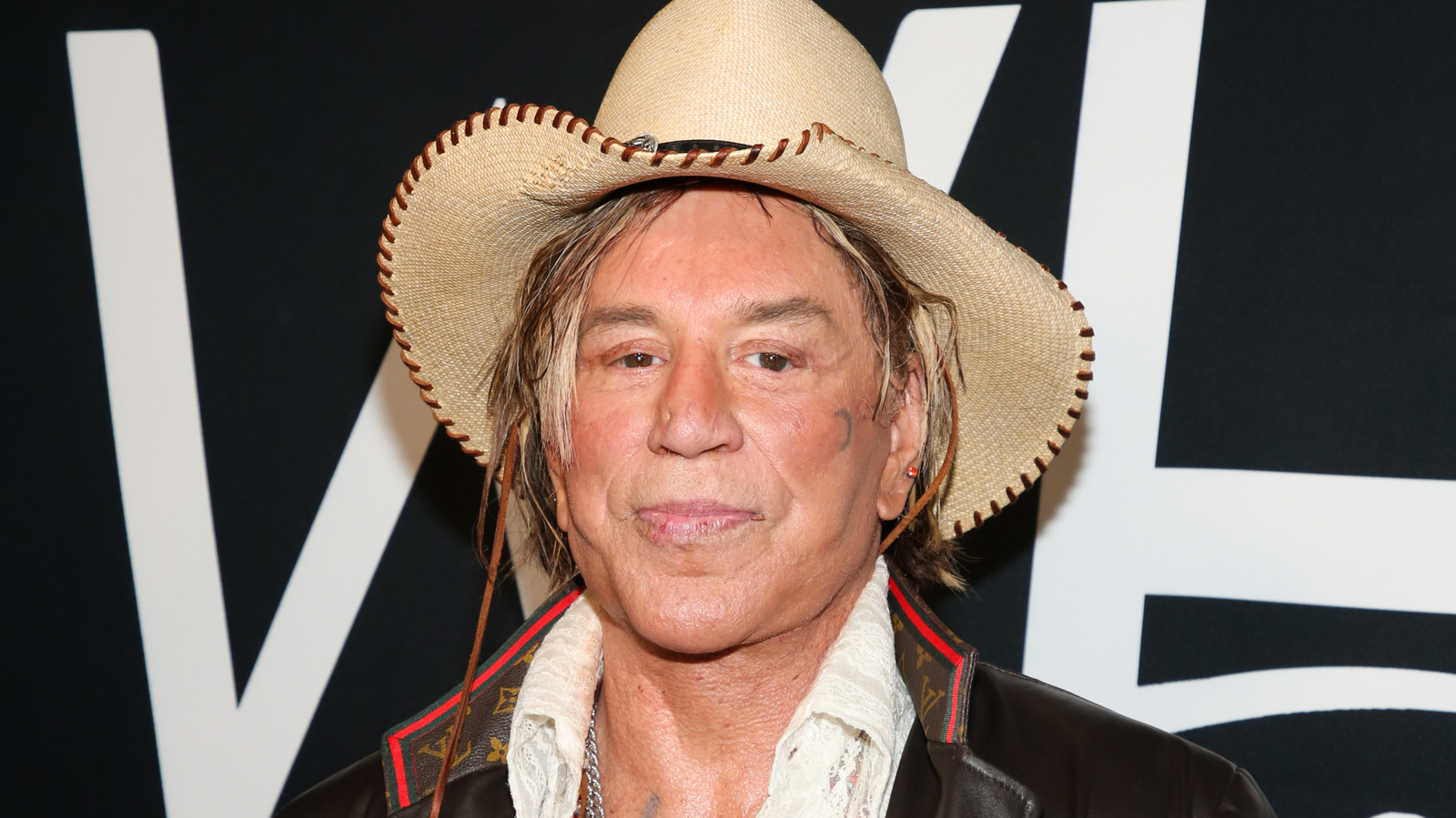 <a href="https://www.thelist.com/1771536/mickey-rourke-plastic-surgery/" target="_blank">Mickey Rourke Looked Wildly Different Before Plastic Surgery</a>