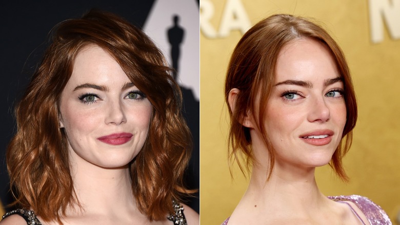 Emma Stone before and after