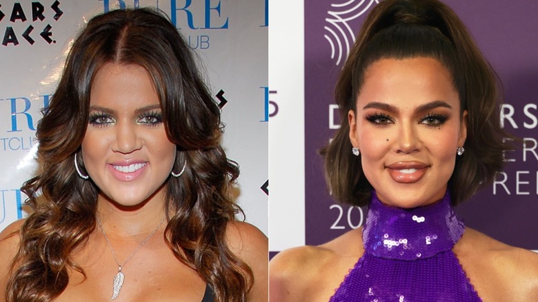 Khloé Kardashian before and after