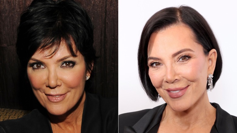 Kris Jenner before and after