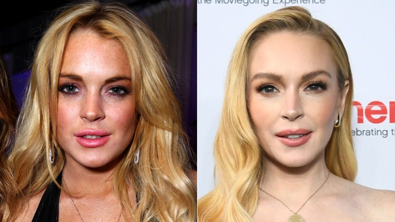 Lindsay Lohan before and after