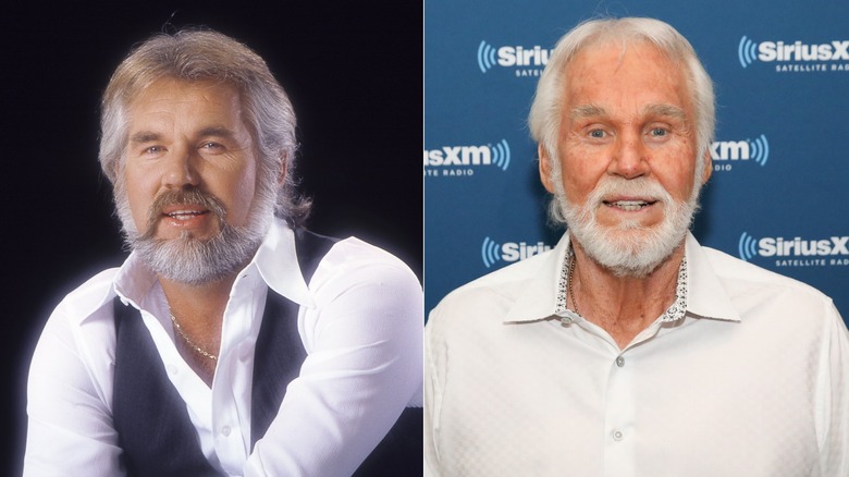 Kenny Rogers before and after plastic surgery