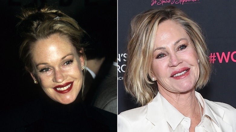 Melanie Griffith before and after plastic surgery