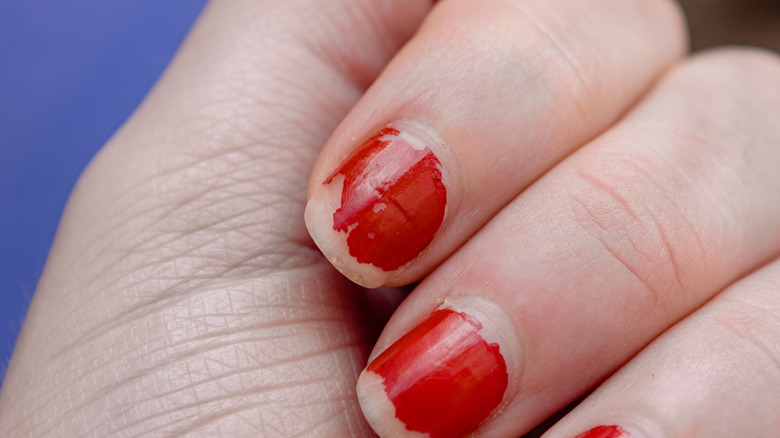 Woman with chipped nail polish