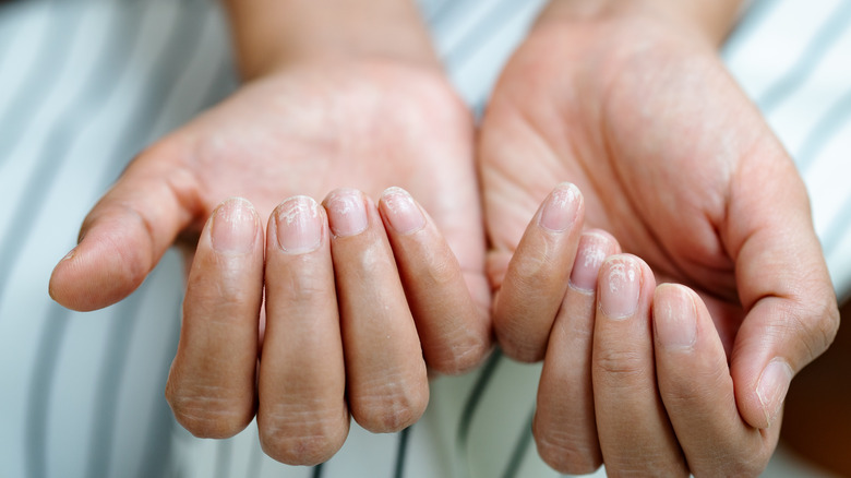 Fingernails on display