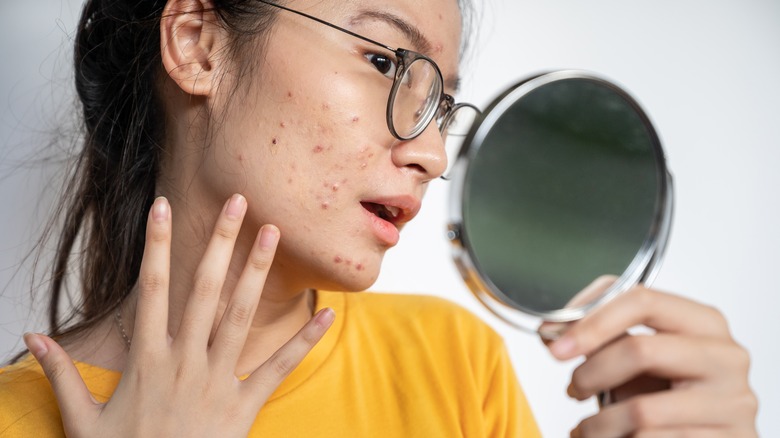 person examining acne in hand-held mirror