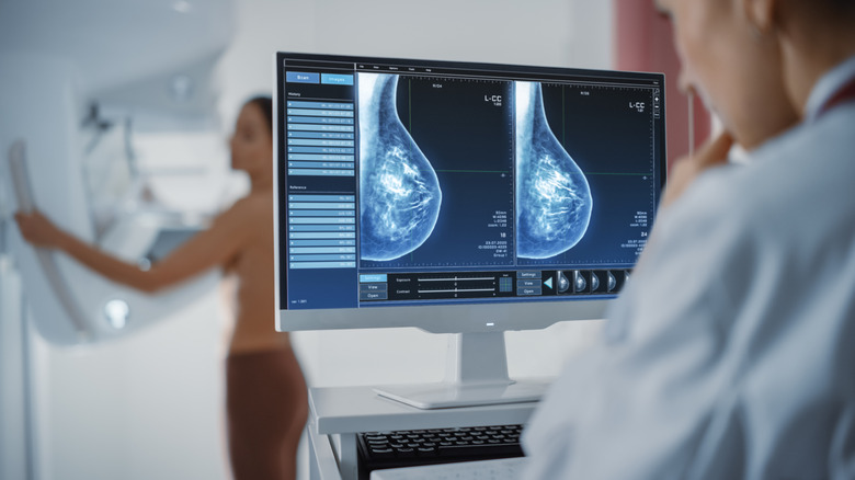Doctor examines mammogram x-ray