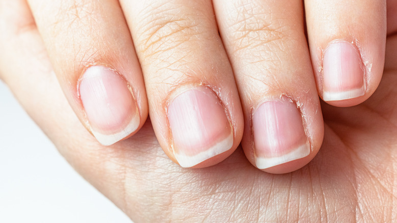 Dry nails