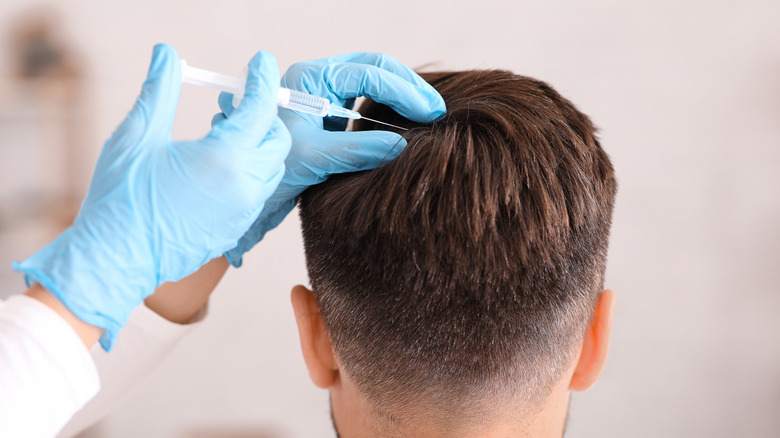 PRP for hair loss Does it work and is it safe