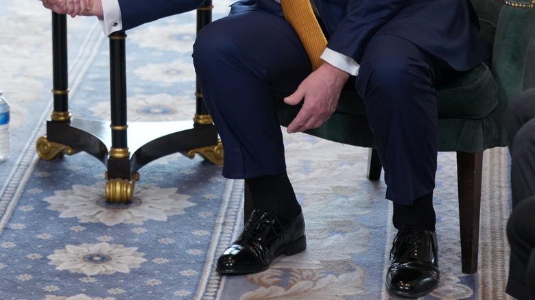 Close up on Donald Trump's swollen ankles.