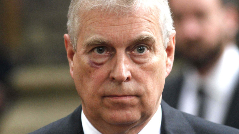 Closeup of Prince Andrew with black eye