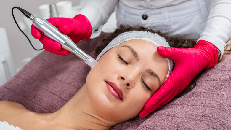 Woman getting microneedling procedure