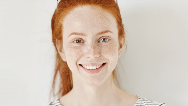 Woman with rare body features of heterochromia and red hair